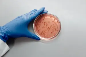 Vědec v modrých rukavicích zkoumá bakteriální kulturu v Petriho misce v laboratorním prostředí.